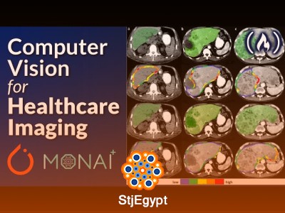 PyTorch & MONAI Healthcare Imaging Course – AI Medical Image Segmentation